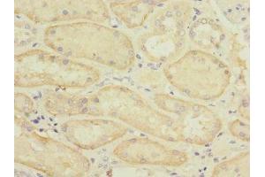 Immunohistochemistry of paraffin-embedded human kidney tissue using ABIN7170165 at dilution of 1:100 (SLC22A8 anticorps  (AA 473-542))
