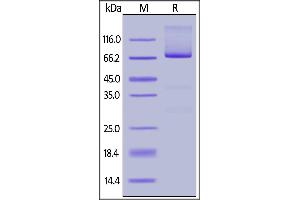 Fed Human Glypican 3, His Tag on  under reducing (R) condition.