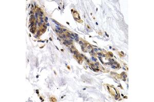Immunohistochemistry of paraffin-embedded human normal breast using PKLR antibody (ABIN5970989) at dilution of 1/200 (40x lens). (PKLR anticorps)
