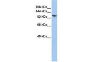 Image no. 1 for anti-Ring Finger Protein 20 (RNF20) (AA 108-157) antibody (ABIN6740810) (RNF20 anticorps  (AA 108-157))