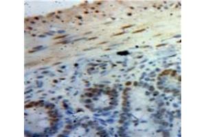 Used in DAB staining on fromalin fixed paraffin-embedded Bowels tissue (HMGA1 anticorps  (AA 3-107))