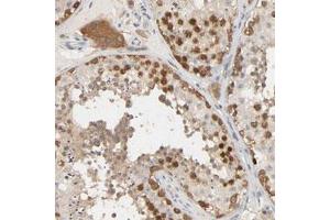 Immunohistochemical staining (Formalin-fixed paraffin-embedded sections) of human testis with MAGEA8 polyclonal antibody  shows strong nuclear and cytoplasmic positivity in cells in seminiferous ducts and strong cytoplasmic positivity in Leydig cells at 1:50-1:200 dilution.