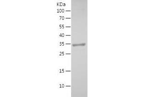 Western Blotting (WB) image for Prosaposin (PSAP) (AA 60-197) protein (His-IF2DI Tag) (ABIN7124603)