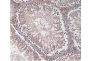 IHC-P analysis of Rat Testis Tissue, with DAB staining. (ORM1 anticorps  (AA 19-186))