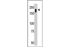 The NCOR1 polyclonal antibody  is used in Western blot to detect NCOR1 in mouse thymus tissue lysate. (NCOR1 anticorps  (N-Term))