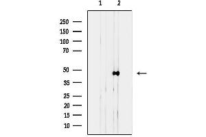 Western blot analysis of lysates from COLO205, using Actin gamma 2 Antibody.
