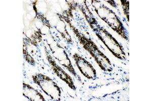 Anti- MCM7 Picoband antibody,IHC(P) IHC(P): Rat Intestine Tissue