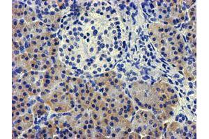 Immunohistochemical staining of paraffin-embedded Human pancreas tissue using anti-LPL mouse monoclonal antibody. (Lipoprotein Lipase anticorps  (AA 28-475))