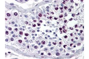 Immunohistochemistry of Rabbit Anti-Cyclin A antibody.