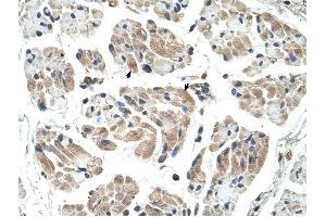 CHST1 antibody was used for immunohistochemistry at a concentration of 4-8 ug/ml to stain Skeletal muscle cells (arrows) in Human Muscle. (CHST1 anticorps)