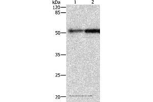 Western blot analysis of Human fetal kidney and lung tissue, using CASP2 Polyclonal Antibody at dilution of 1:950 (Caspase 2 anticorps)