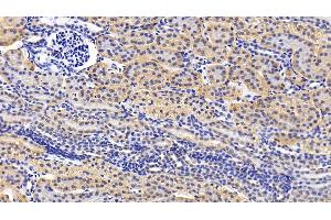 Detection of ATG16L1 in Human Kidney Tissue using Polyclonal Antibody to Autophagy Related Protein 16 Like Protein 1 (ATG16L1) (ATG16L1 anticorps  (AA 342-607))