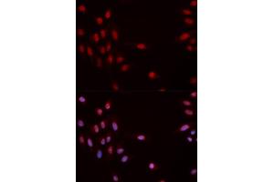 Immunofluorescence (IF) image for anti-Checkpoint Kinase 1 (CHEK1) (pSer317) antibody (ABIN1870071)
