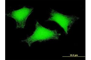 Immunofluorescence of monoclonal antibody to SPEF2 on HeLa cell.