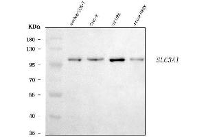 Western blot analysis of SLC3A1 using anti-SLC3A1 antibody (ABIN7602354).