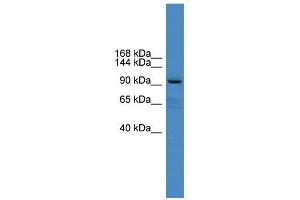 XYLT1 antibody used at 0. (XYLT1 anticorps  (Middle Region))