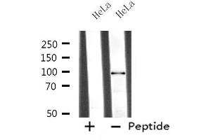 Western blot analysis of extracts from HeLa cells, using MASTL antibody. (MASTL anticorps  (C-Term))