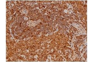 ABIN6256196 and ABIN6267433 at 1/200 staining Rat spleen tissue sections by IHC-P.