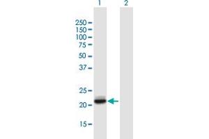 Western Blot analysis of LCN2 expression in transfected 293T cell line by LCN2 MaxPab polyclonal antibody.