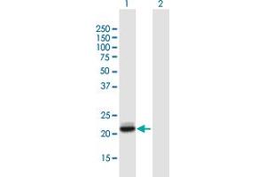 Western Blot analysis of LCN2 expression in transfected 293T cell line by LCN2 MaxPab polyclonal antibody. (Lipocalin 2 anticorps  (AA 1-198))
