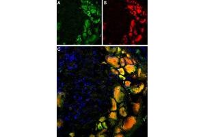 Multiplex staining of TRPV1 and mGluR5 in rat DRG - Immunohistochemical staining of rat dorsal root ganglion using Anti-Rat TRPV1 (VR1) (extracellular)-ATTO Fluor-488 Antibody (ABIN7043839), (1:60) and Anti-mGluR5 (extracellular)-ATTO Fluor-594 Antibody (ABIN7043251), (1:60). (Metabotropic Glutamate Receptor 5 anticorps  (Extracellular, N-Term) (Atto 594))