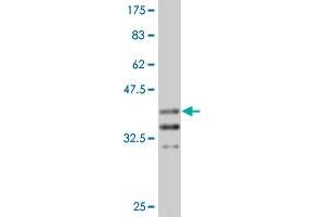 Western Blot detection against Immunogen (37. (Arx anticorps  (AA 159-264))