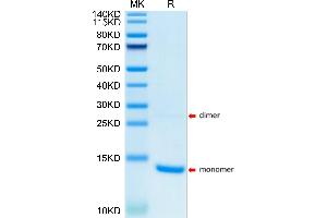 Human S100A9/MRP14 on Tris-Bis PAGE under reduced condition.