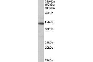 Western Blotting (WB) image for anti-Isocitrate Dehydrogenase 2 (NADP+), Mitochondrial (IDH2) antibody (ABIN5884864) (IDH2 anticorps)