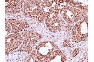 IHC-P Image Immunohistochemical analysis of paraffin-embedded NCIN87 xenograft, using FIS1, antibody at 1:100 dilution.