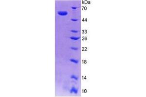 SDS-PAGE analysis of Human SPR Protein. (SPR Protéine)