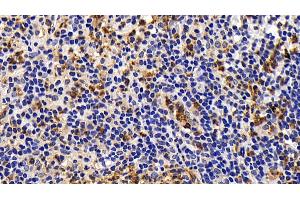 Detection of Bcl2L in Human Appendix Tissue using Monoclonal Antibody to B-Cell CLL/Lymphoma 2 Like Protein (Bcl2L) (BCL2L1 anticorps  (AA 2-212))