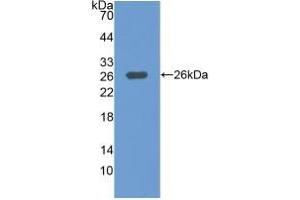 Detection of Recombinant MAP3K1, Human using Polyclonal Antibody to Mitogen Activated Protein Kinase Kinase Kinase 1 (MAP3K1) (MAP3K1 anticorps  (AA 1307-1509))