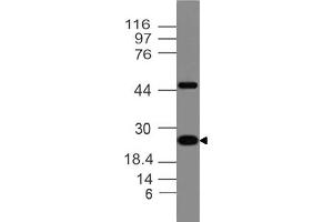 Image no. 1 for anti-Adiponectin (ADIPOQ) (AA 40-230) antibody (ABIN5027479) (ADIPOQ anticorps  (AA 40-230))