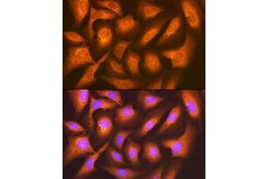 Immunofluorescence analysis of U-2 OS cells using F/UBD Rabbit mAb (ABIN7271134) at dilution of 1:100 (40x lens). (UBD anticorps)