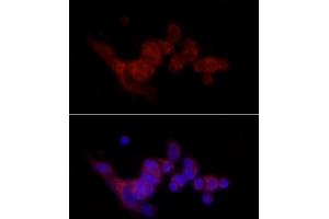 Immunofluorescence analysis of MCF7 cells using SREBF1 Rabbit pAb (ABIN7270598) at dilution of 1:100 (40x lens).