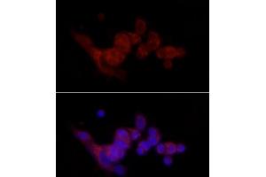 Immunofluorescence analysis of MCF7 cells using SREBF1 Rabbit pAb (ABIN7270598) at dilution of 1:100 (40x lens). (SREBF1 anticorps  (AA 1-100))