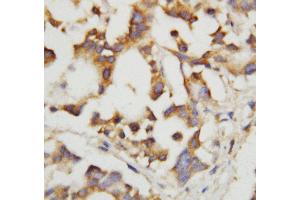 Anti-Cystathionase antibody, IHC(P) IHC(P): Human Liver Tissue