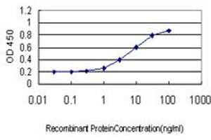 Detection limit for recombinant GST tagged SMC6L1 is approximately 0.