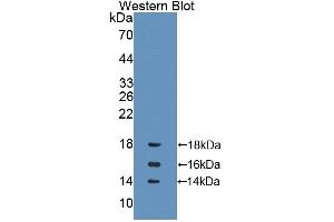 Detection of Recombinant IL15, Rat using Polyclonal Antibody to Interleukin 15 (IL15) (IL-15 anticorps  (AA 49-162))
