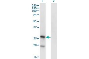 Western Blot analysis of KLRA1 expression in transfected 293T cell line by KLRA1 monoclonal antibody (M01), clone 1H3.