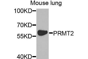 Western blot analysis of extracts of mouse lung cells, using PRMT2 antibody. (PRMT2 anticorps)