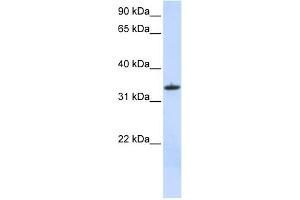 WB Suggested Anti-MRPL15 Antibody Titration:  0. (MRPL15 anticorps  (C-Term))