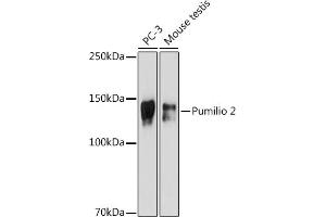 Western blot analysis of extracts of various cell lines, using Pumilio 2 antibody (ABIN7269747) at 1:500 dilution. (PUM2 anticorps)