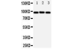 Western Blotting (WB) image for anti-ATP-Binding Cassette, Sub-Family B (MDR/TAP), Member 6 (ABCB6) (AA 818-842), (C-Term) antibody (ABIN3044283)