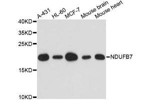 Western blot analysis of extracts of various cell lines, using NDUFB7 antibody. (NDUFB7 anticorps  (AA 1-137))