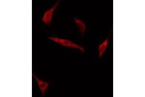 ABIN6275159 staining HuvEc cells by IF/ICC.
