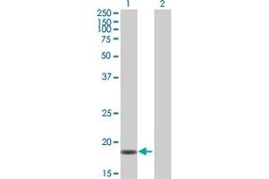 Western Blot analysis of PPIL3 expression in transfected 293T cell line by PPIL3 MaxPab polyclonal antibody. (PPIL3 anticorps  (AA 1-161))
