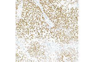 anti-p40 (p63 Delta) (AA 1-50) antibody