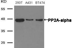 Western blot analysis of extracts from 293T, A431 and BT474 cells using PP2A-alpha antibody.