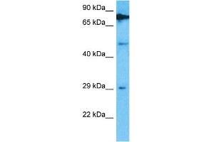 Host:  Rabbit  Target Name:  TRMT61B  Sample Type:  Hela Whole Cell lysates  Antibody Dilution:  1. (TRMT61B anticorps  (C-Term))